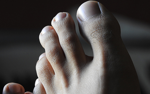 Causes and treatments of common foot problems