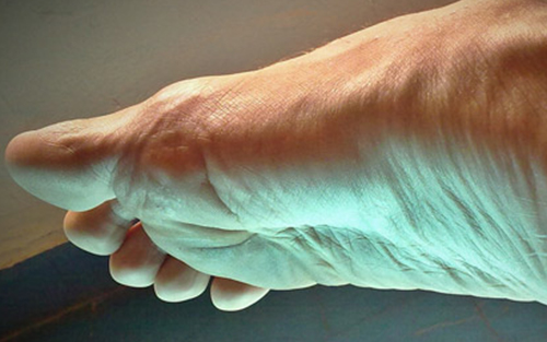 Muscle pain can occur anywhere in the body including the feet